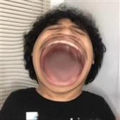 Kh