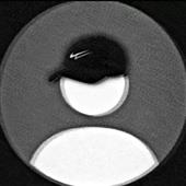 Nh