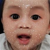Cổ
