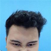 An