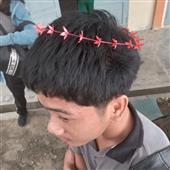 VI