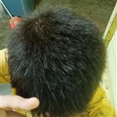 Bộ