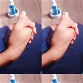 Rồ