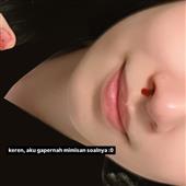 Gi