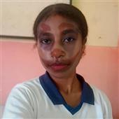 Ng